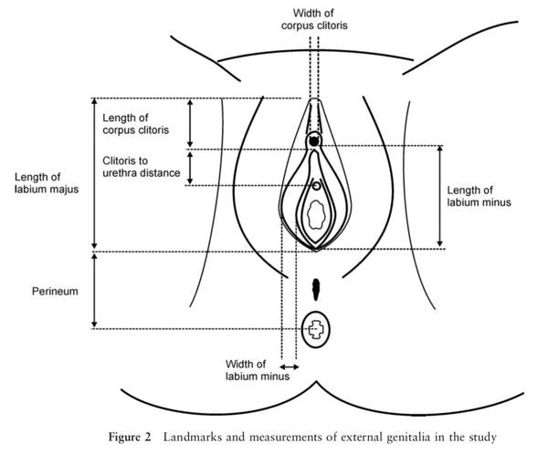 What Does A "Normal" Vulva Look Like?